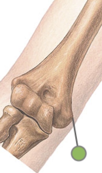 <p>Which bone landmark of the humerus is a bony knob above trochlea on the medial side?</p>