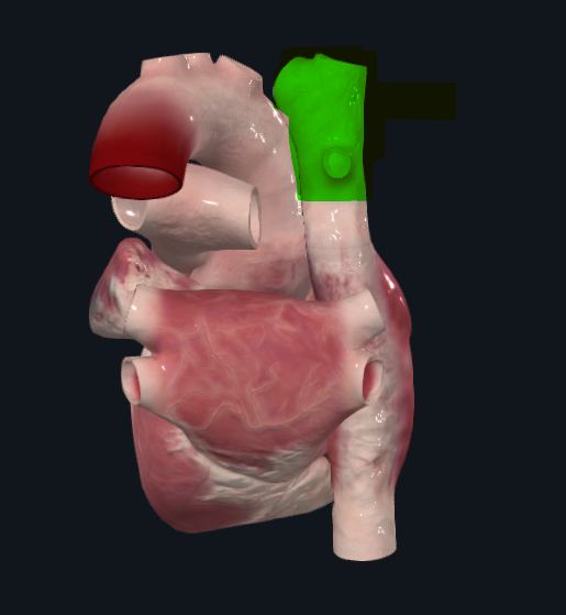 <p>Vena que conduce la sangre venosa de la cabeza, cuello, miembros superiores y tórax y las transporta hacia la aurícula derecha del corazón</p>