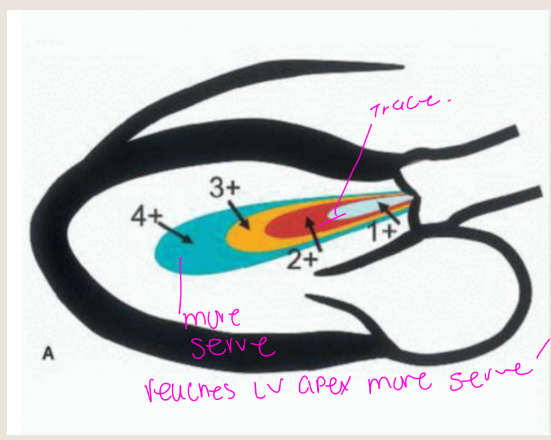 <p>Unreliable due to</p><p>diastolic blood pressure</p><p>and acute AR</p>