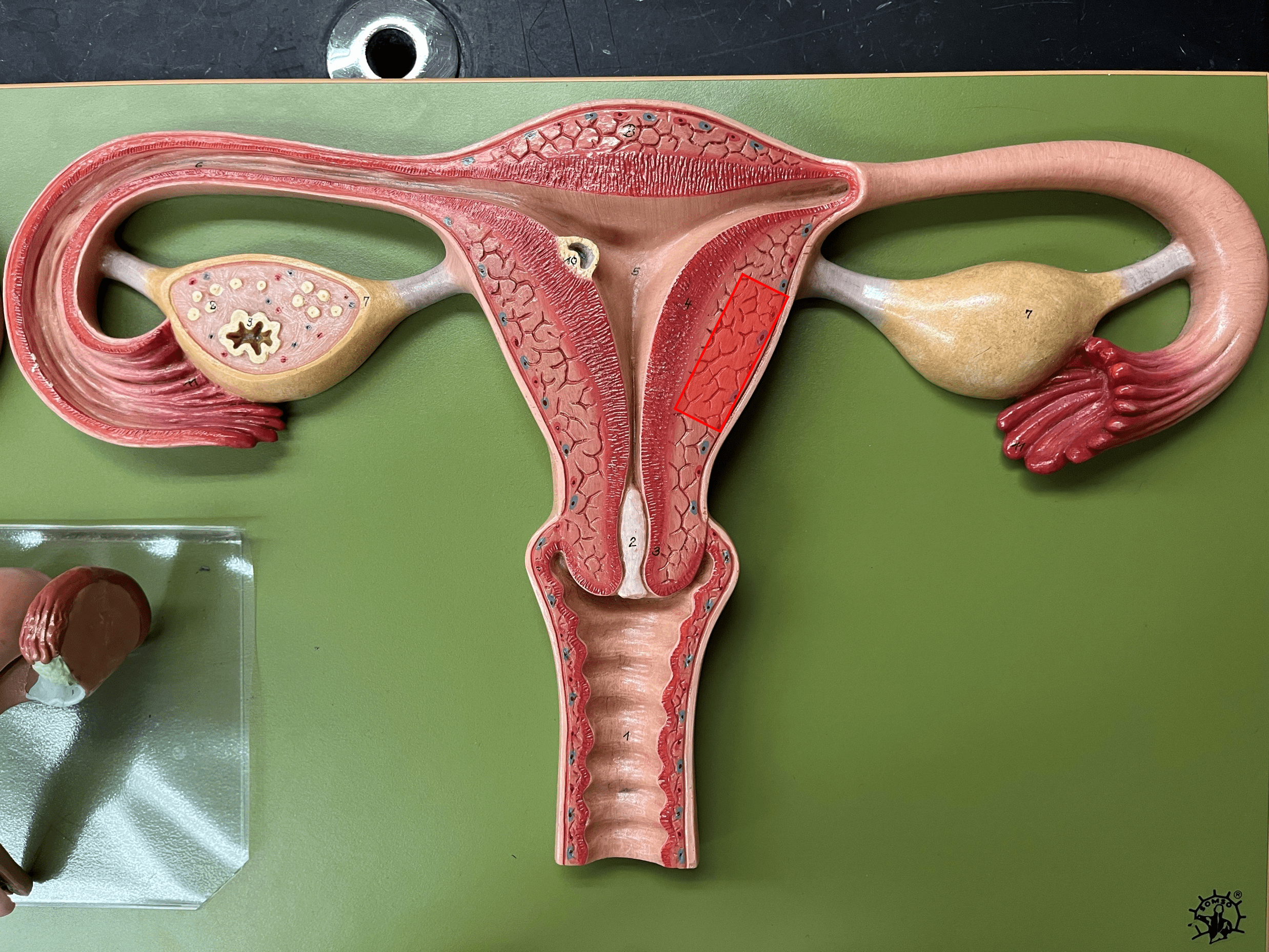 • Part of the wall of the uterus.

• The thick layer composed of smooth muscle.