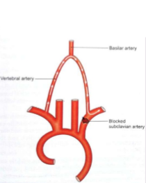 <ol><li><p>What pathology is occurring here?&nbsp;</p></li><li><p>Explain why you think that.&nbsp;</p></li></ol><p></p>