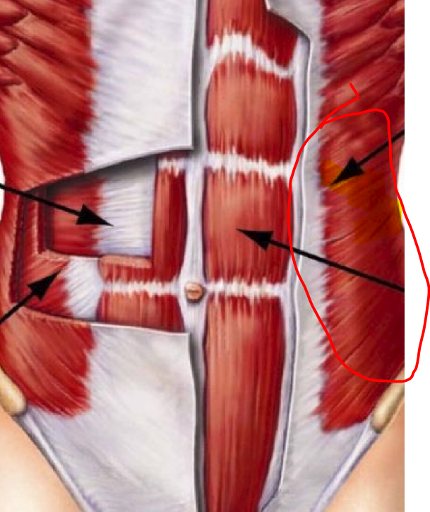 <p>PA -flex vertebral colum -lateral flexion</p><p>fibers run diagonally up down /</p>