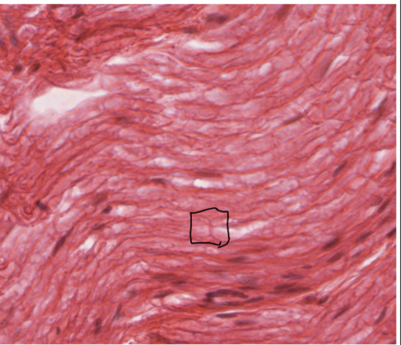 <p>Identify the structure (black box)</p>