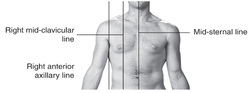 <p>Vertical line running down the <strong>midline of the sternum</strong> on the anterior chest.</p>