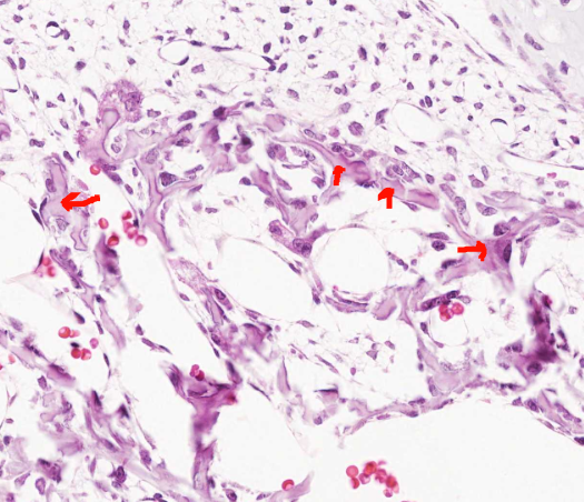 <ol start="2"><li><p>What cells have produced this matrix</p></li></ol><p>Foetal head, coronal section, haematoxylin and eosin</p>