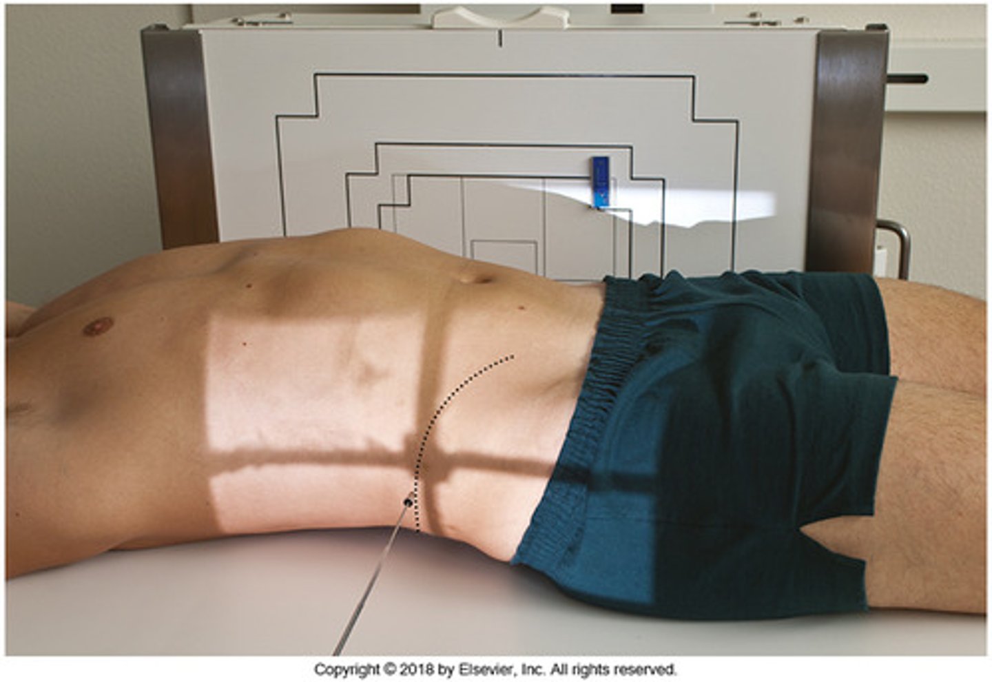 <p>(L Lateral projection)</p>