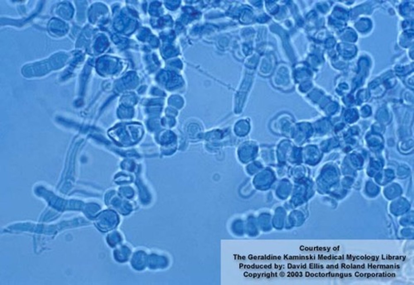 <p>"Antler" hyphae</p>
