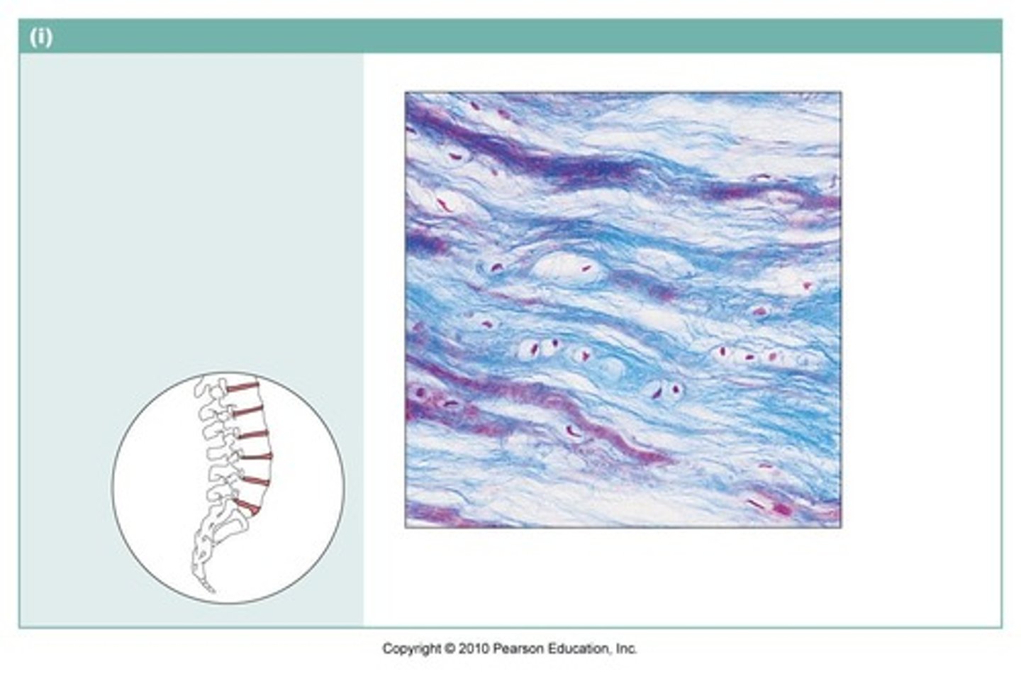 <p>Thick collagen bundles; intervertebral discs, pubic symphysis</p>