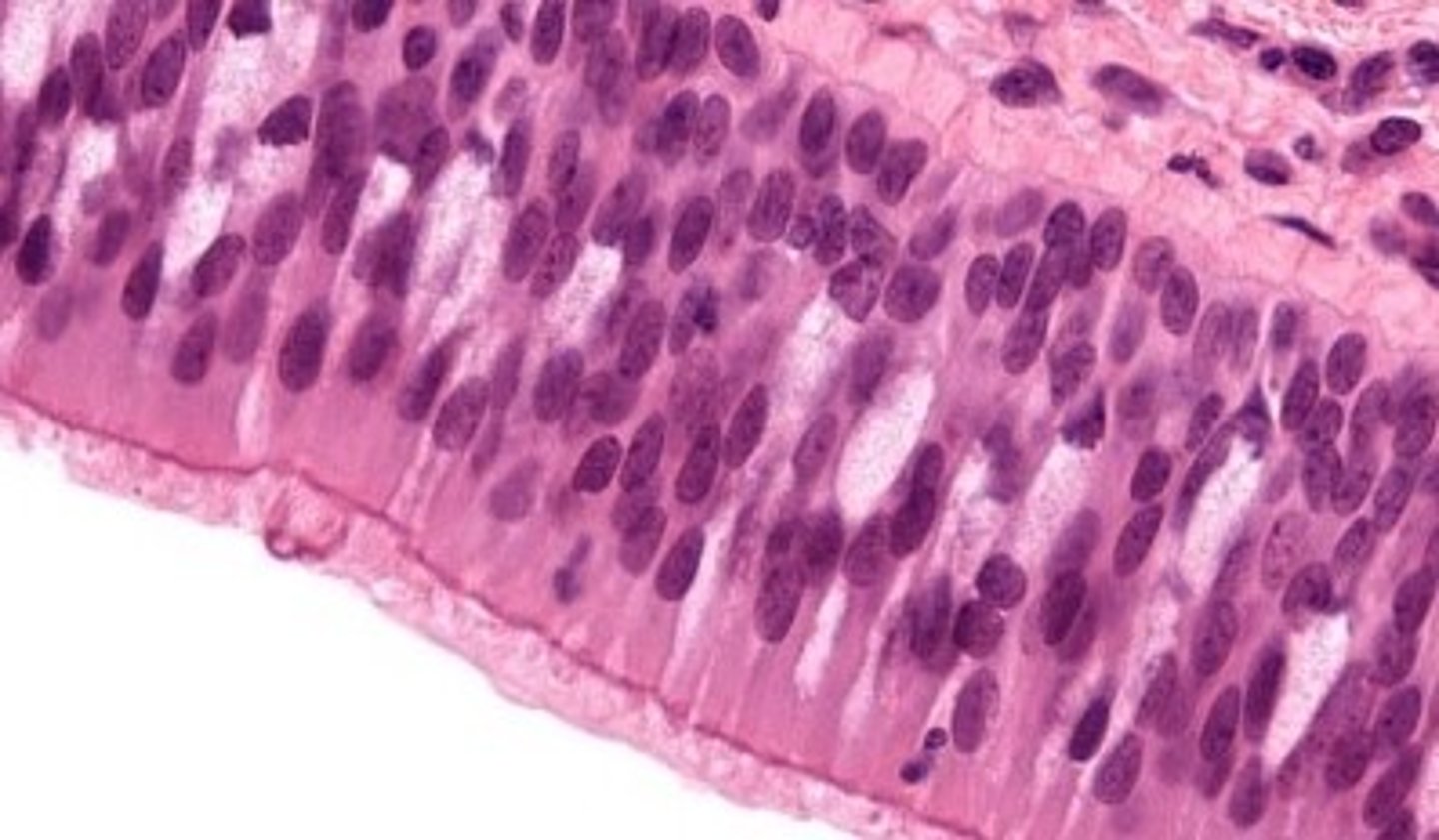 <p>upper fold of the larynx, the false vocal cord</p>
