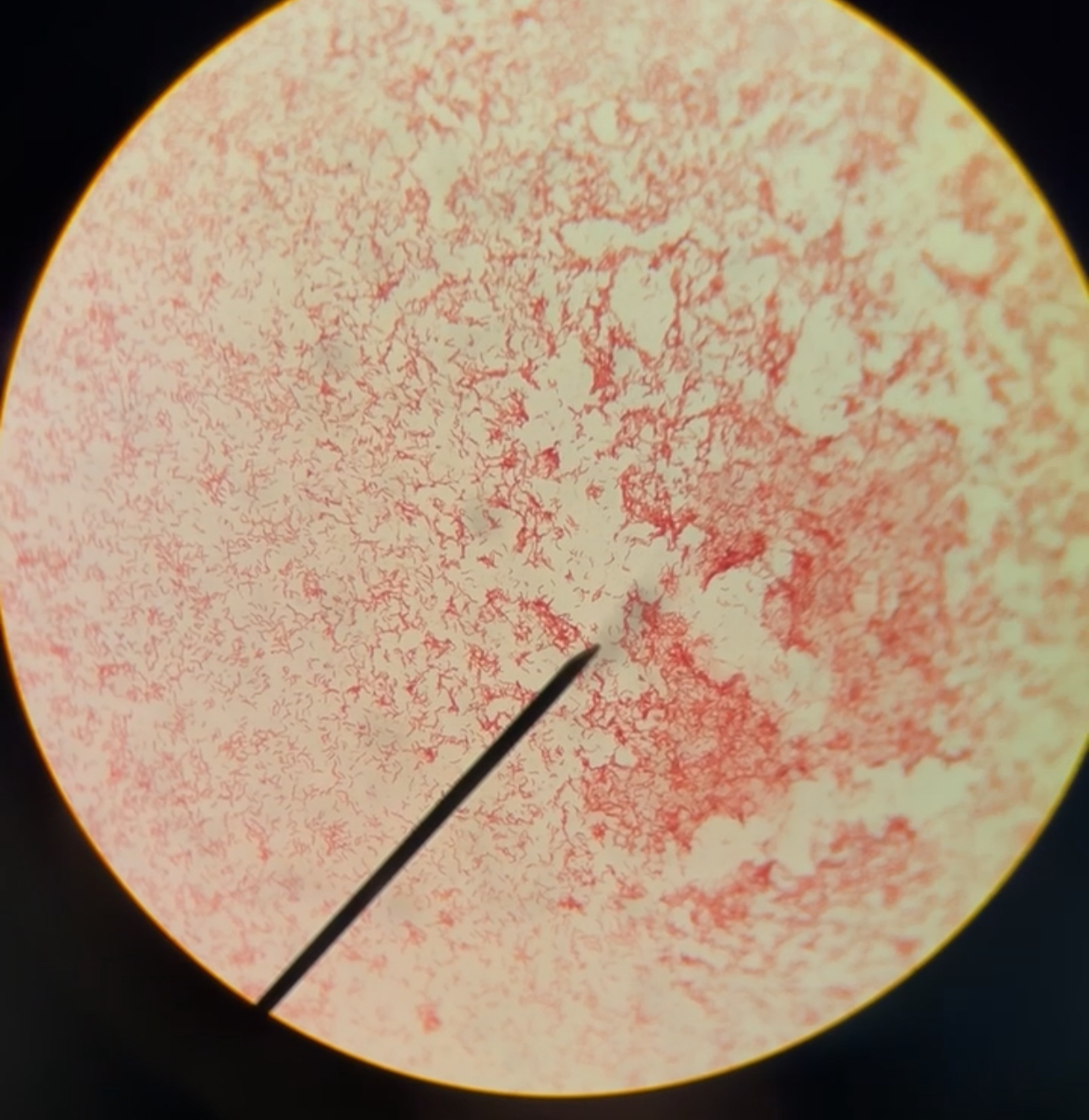 <p>What shape is this bacteria?</p>