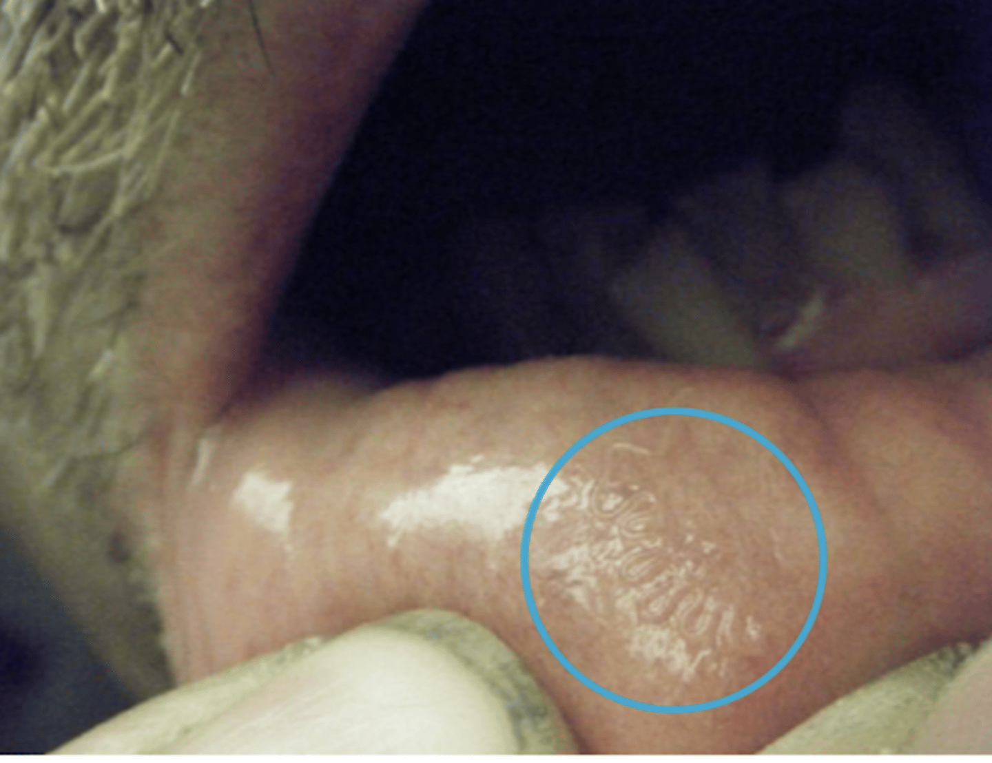 <p>what parasite is in this animal's mouth?</p>