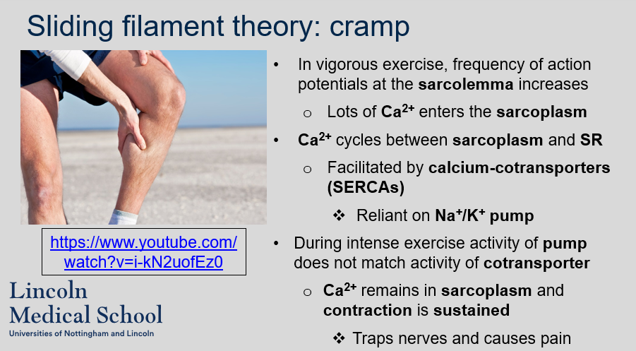 <p>In vigorous exercise, frequency of action potentials at the sarcolemma increases thus lots of Ca2+ enters the sarcoplasm. Ca2+ cycles between the sarcoplasm and SR which is facilitated by calcium-cotransporters (SERCAs). However, during intense exercise, the activity of the Na+/K+ pump, which is reliant on the activity of cotransporter, does not match the activity of the cotransporter, causing Ca2+ to remain in the sarcoplasm and sustain contraction. This can trap nerves and cause pain.</p>