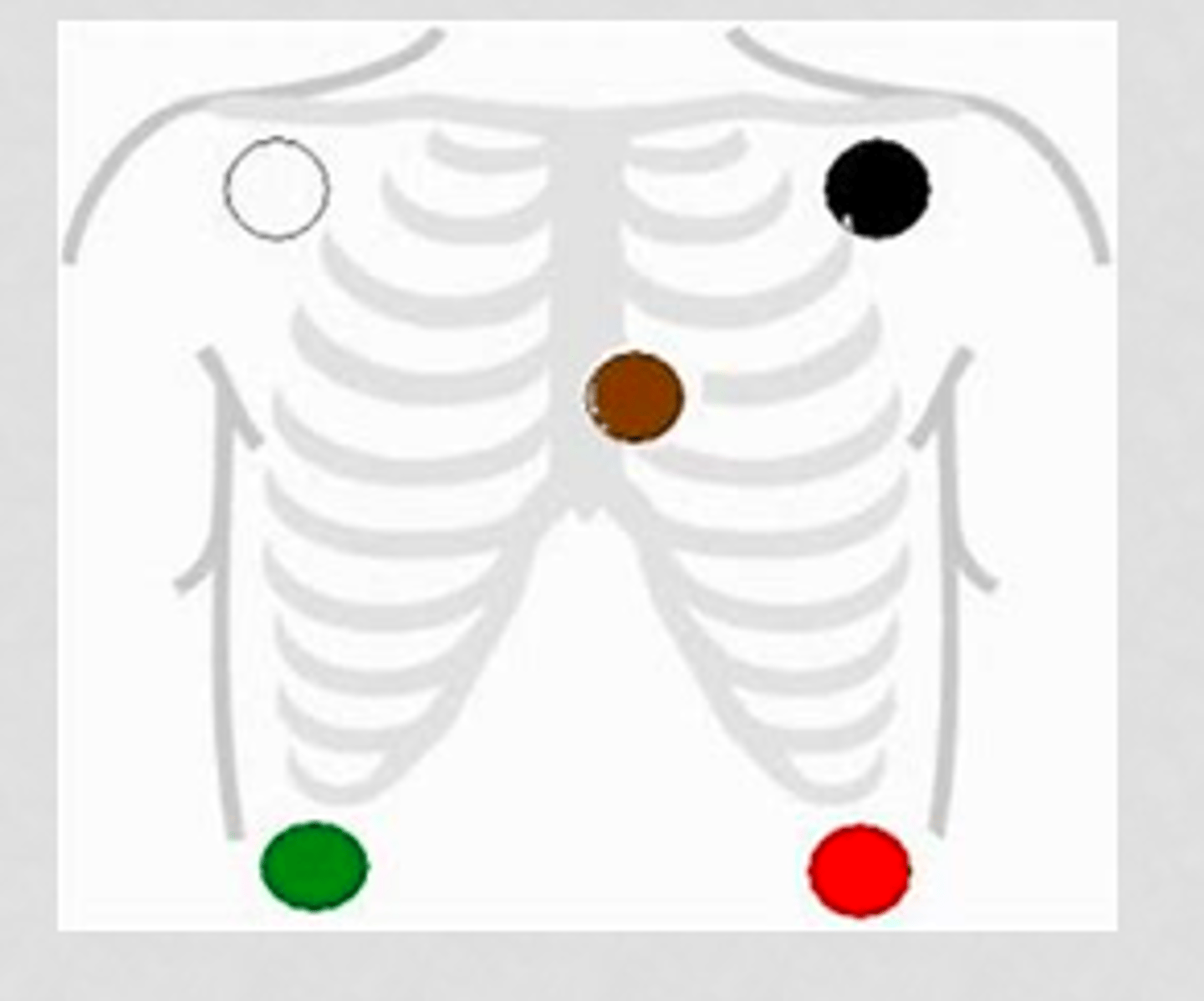 <p>White to upper right, green to lower right, black to upper right, red to lower left, brown in the center</p><p>Snow over grass, smoke over fire, chocolate close to the heart</p>