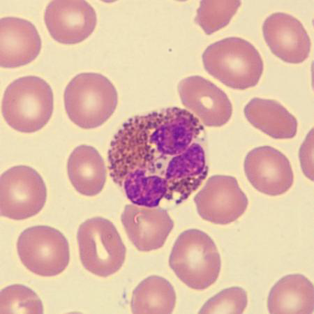 <p>What is this leukocyte?</p>