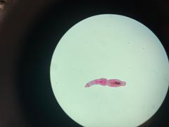 <p>What is the genus species of this tapeworm? It is the smallest cestode of the family Taeniidae</p>