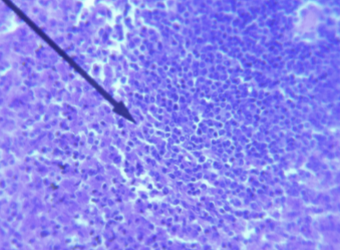 <p>what kind of tissue is this </p>