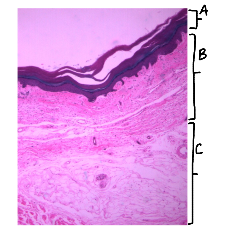 <p>What is this a picture of? Identify the highlighted structures and describe them.</p>
