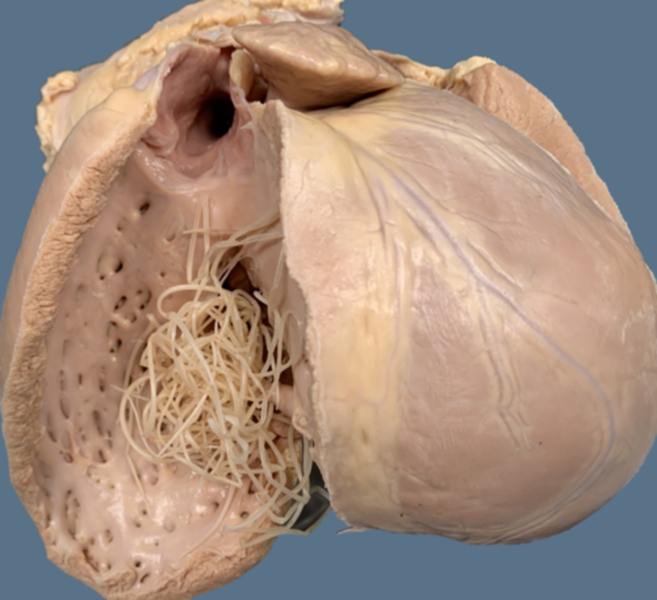 <p>What is true of the right side of a heart with heartworms?</p>