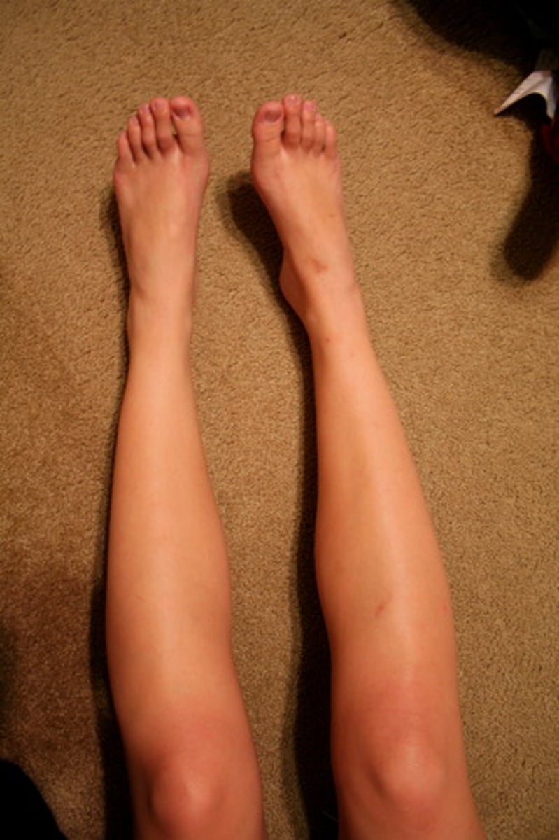 <p>shin-front of the lower leg</p>