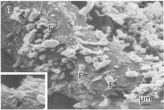 light color = microbes dark color = feed particles