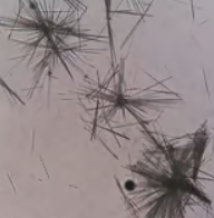 <p>What type of acid urine crystal is this?</p>