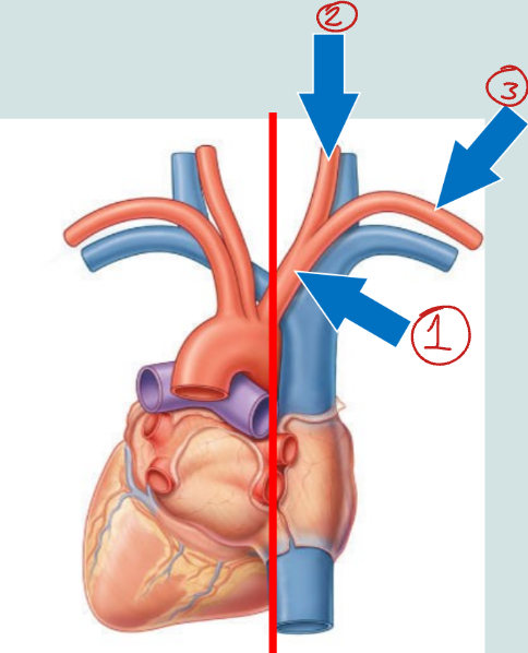 <p>Label this diagram.</p>