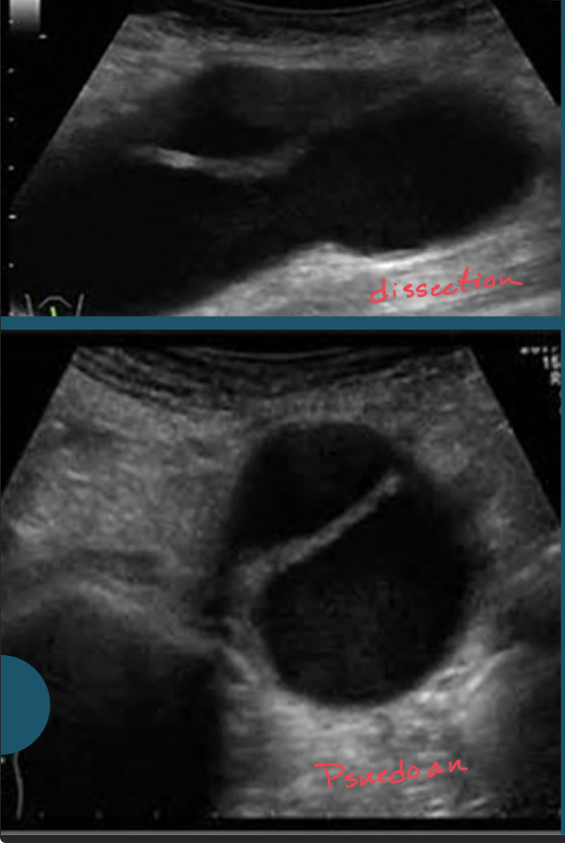 <p>This is a picture of a (vascular)</p>