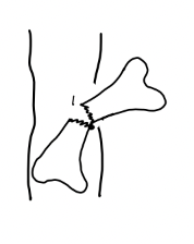<p><br><span>what type of skin penetration is this?</span></p>