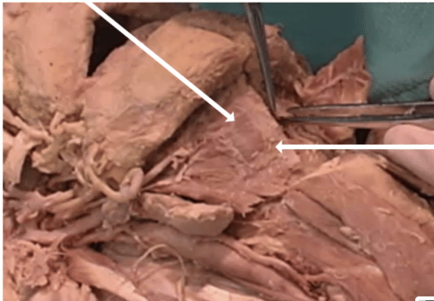 <p>-stylohyoid</p><p>-digastric</p><p>-geniohyoid</p><p>-mylohyoid</p>
