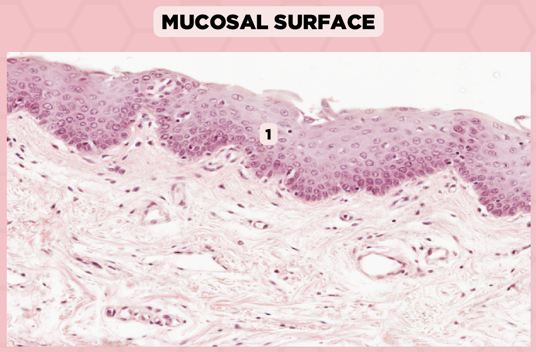 <p>Identify the structure labelled in the given image?</p><p>a. Epidermis</p><p>b. Dermis</p><p>c. Hypodermis</p><p>d. Mucosa/Mucous Membrane</p>