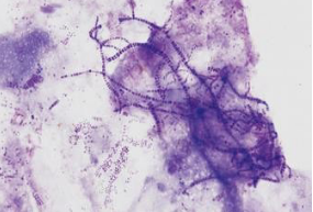 <p><span style="font-family: &quot;Segoe UI Semibold&quot;, sans-serif; line-height: 107%;"><span>Gram-positive, small branching filaments arranged in a “railroad track” shape.</span></span></p>