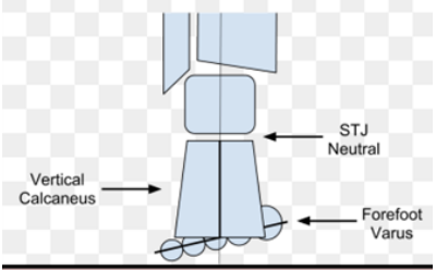 <p>- Inversion of forefoot</p><p>- subtalar joint in neutral</p>