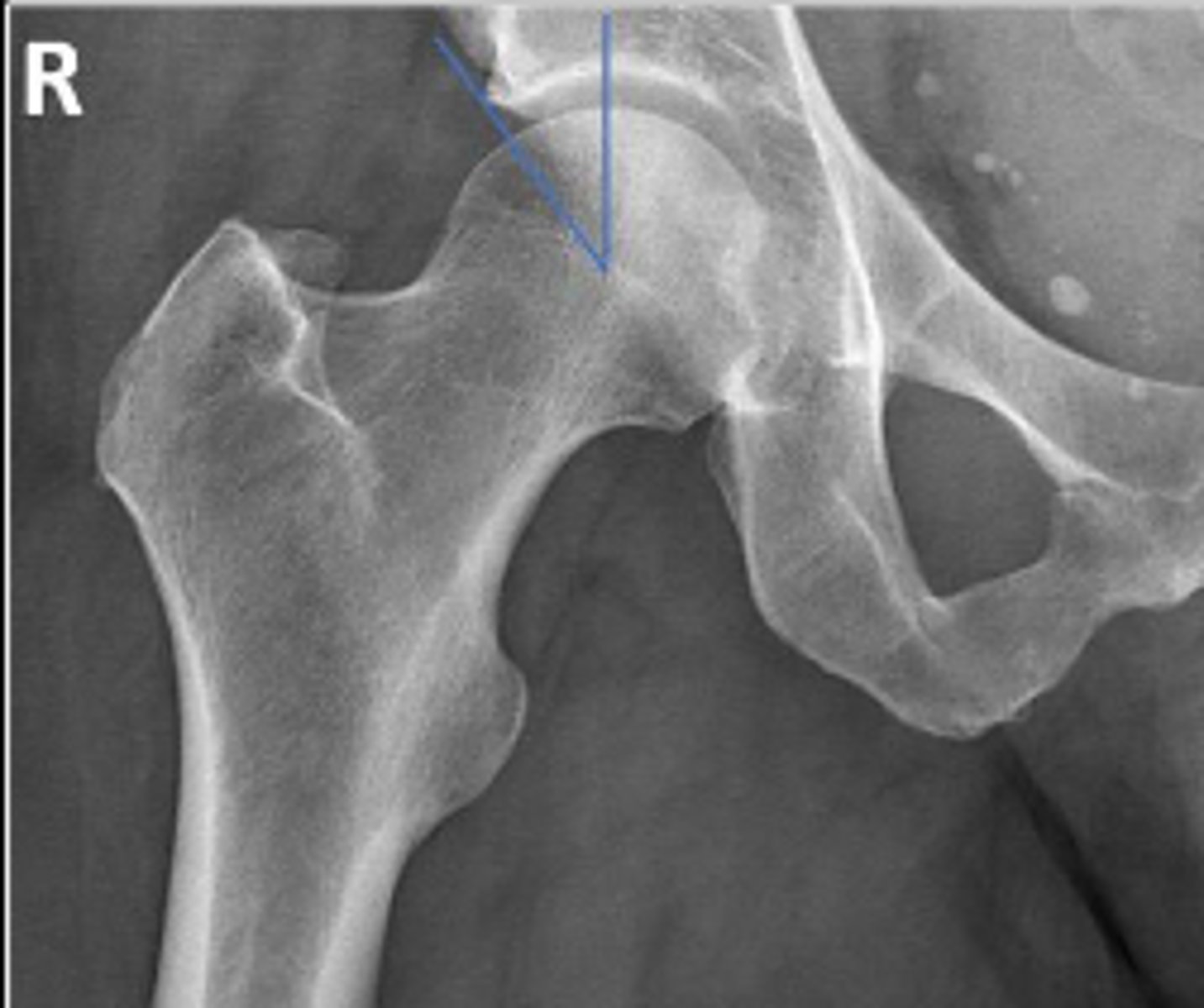 <p>What is the normal range for this assessment?</p>