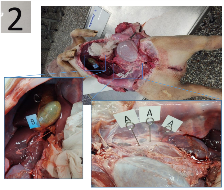 <p>Ureter</p>