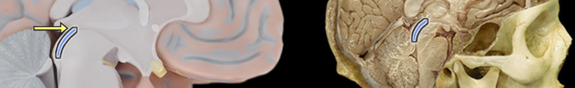 <p>Location:</p><ul><li><p>Midbrain</p></li></ul><p>Description:</p><ul><li><p>Narrow midline channel between third and fourth ventricles</p></li><li><p>Filled with cerebrospinal fluid</p></li></ul><p>Comment:</p><ul><li><p>Cerebral ventricular system includes: (1) paired lateral ventricles; (2) interventricular foramena (Monro); (3) unpaired third ventricle; (4) cerebral aqueduct (Sylvius); and (5) unpaired fourth ventricle</p></li></ul><p></p>