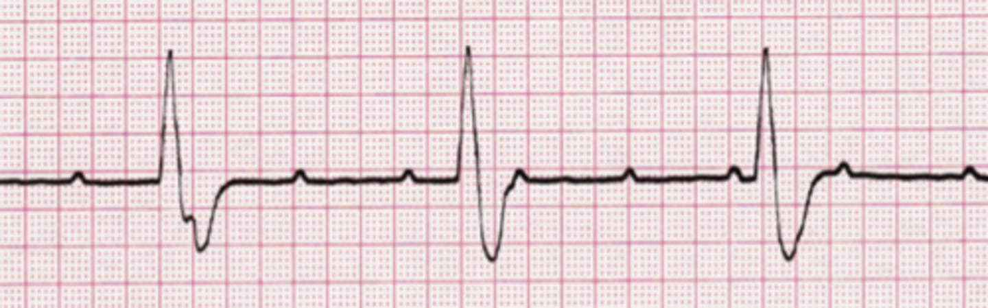 <p>Name the rhythm</p>