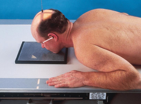 <ul><li><p>head positioned as described using Water’s method</p></li><li><p>less extension of the patient’s neck to increase angulation of OML</p><ul><li><p>OML is more perpendicular to IR plane</p></li></ul></li><li><p>good to demonstrate blowout fractures</p></li><li><p>patient position:</p><ul><li><p>prone or upright</p></li><li><p>MSP centered</p></li></ul></li><li><p>part position:</p><ul><li><p>rest head on tip of extended chin</p><ul><li><p>nose touhcing IR</p></li><li><p>less extension of neck</p></li></ul></li><li><p>OML forms 55 degree angle with IR plane</p></li><li><p>MML perpendicular to IR</p></li><li><p>MSP perpendicular to IR</p></li><li><p>IR centered at level of acanthion</p></li></ul></li></ul><ul><li><p>respiration suspended</p></li></ul><ul><li><p>CR:</p><ul><li><p>perpendicular, exiting acanthion</p></li></ul></li></ul><ul><li><p>collimation:</p><ul><li><p>1 inch beyond the shadows of the lateral sides of the face, superiory to include the supraorbital margins, and inferiorly to the level of the chin</p></li><li><p>no larger than 8 × 10 inches</p></li></ul></li></ul><p></p>