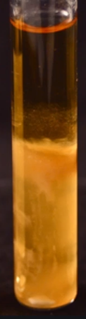 <p>What this Thioglycollate result tube indicates?</p><p>Growth only at the bottom of the tube</p>