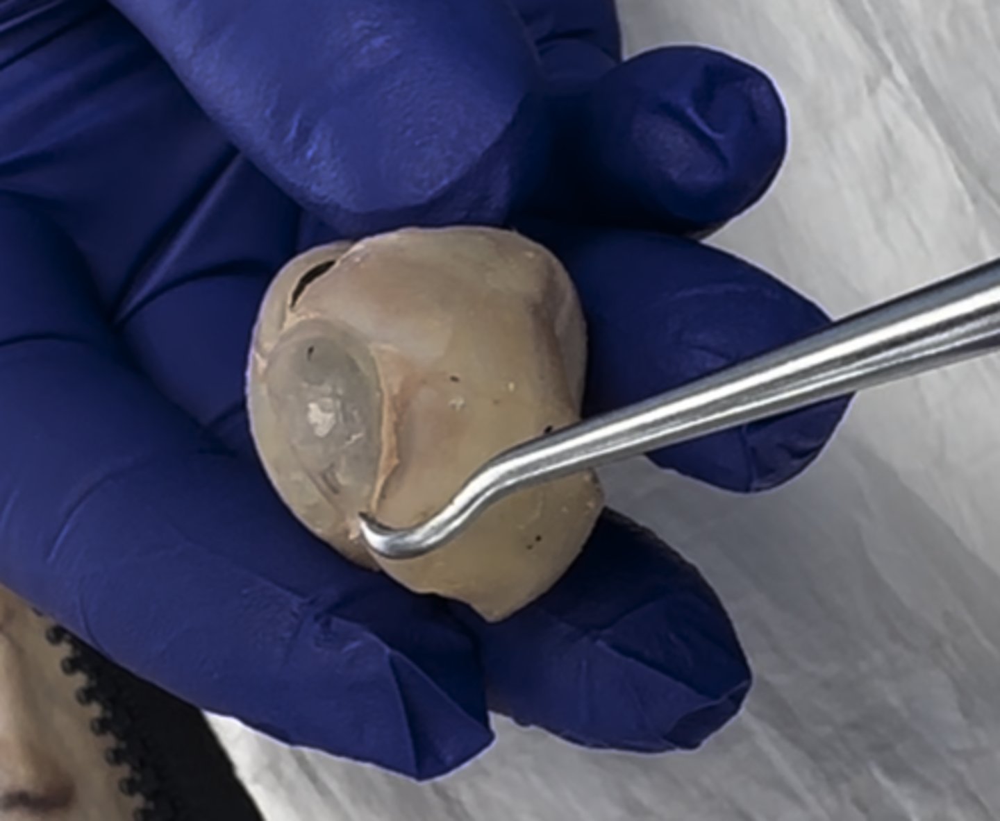 <p>The outer bulge part in the front of the eye is the</p>