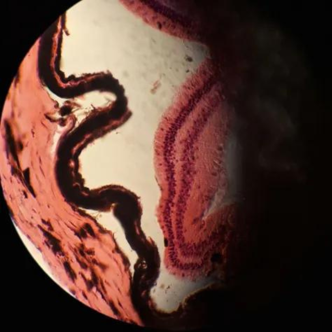term image