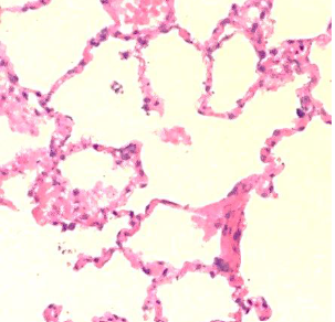 <p>Simple squamous epithelium function</p>