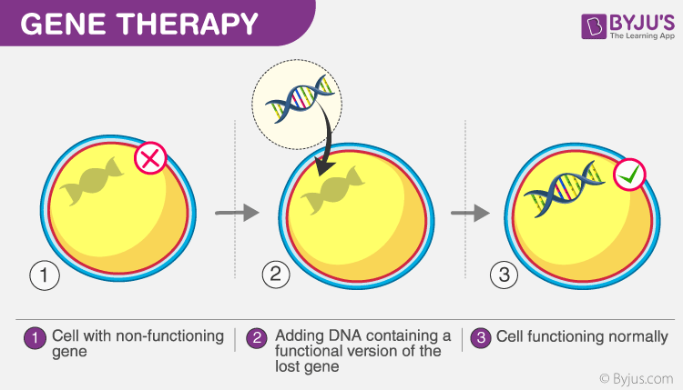 <p>A genetic engineering process where viral vectors are used to deliver a working copy of a gene with a non-working copy.</p>