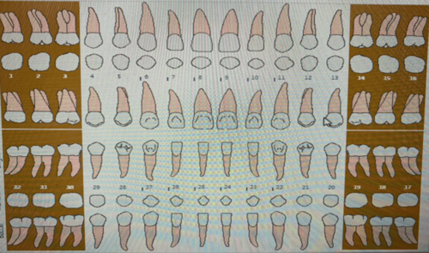 knowt flashcard image