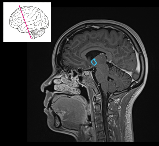 <p>Maintains homeostasis (temperature, hunger, sleep) and regulates hormones via the pituitary.</p>