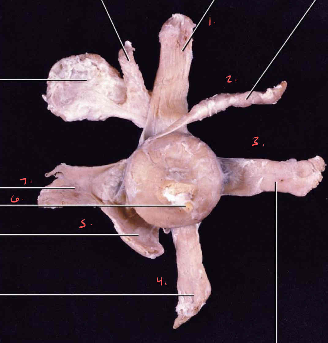 term image