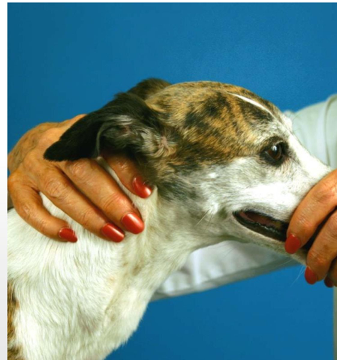 <p>when we palpate the trapezius muscle, what nerve are we testing?</p>