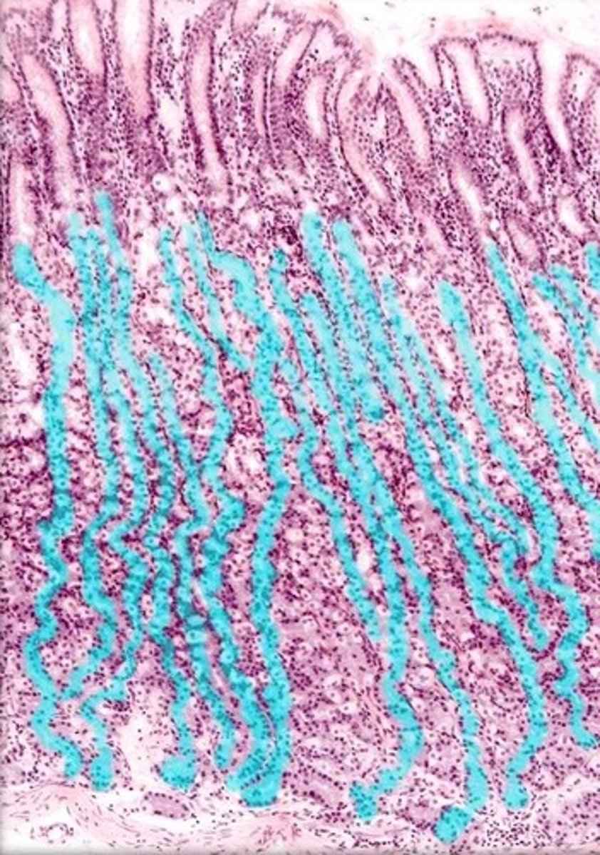 knowt flashcard image