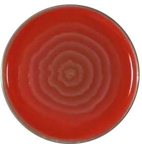 <p>Based on the growth on a BA plate, which of the bacteria that are in this Knowt (Klebsiella, Enterobacter, Citrobacter, Proteus) is this?</p>