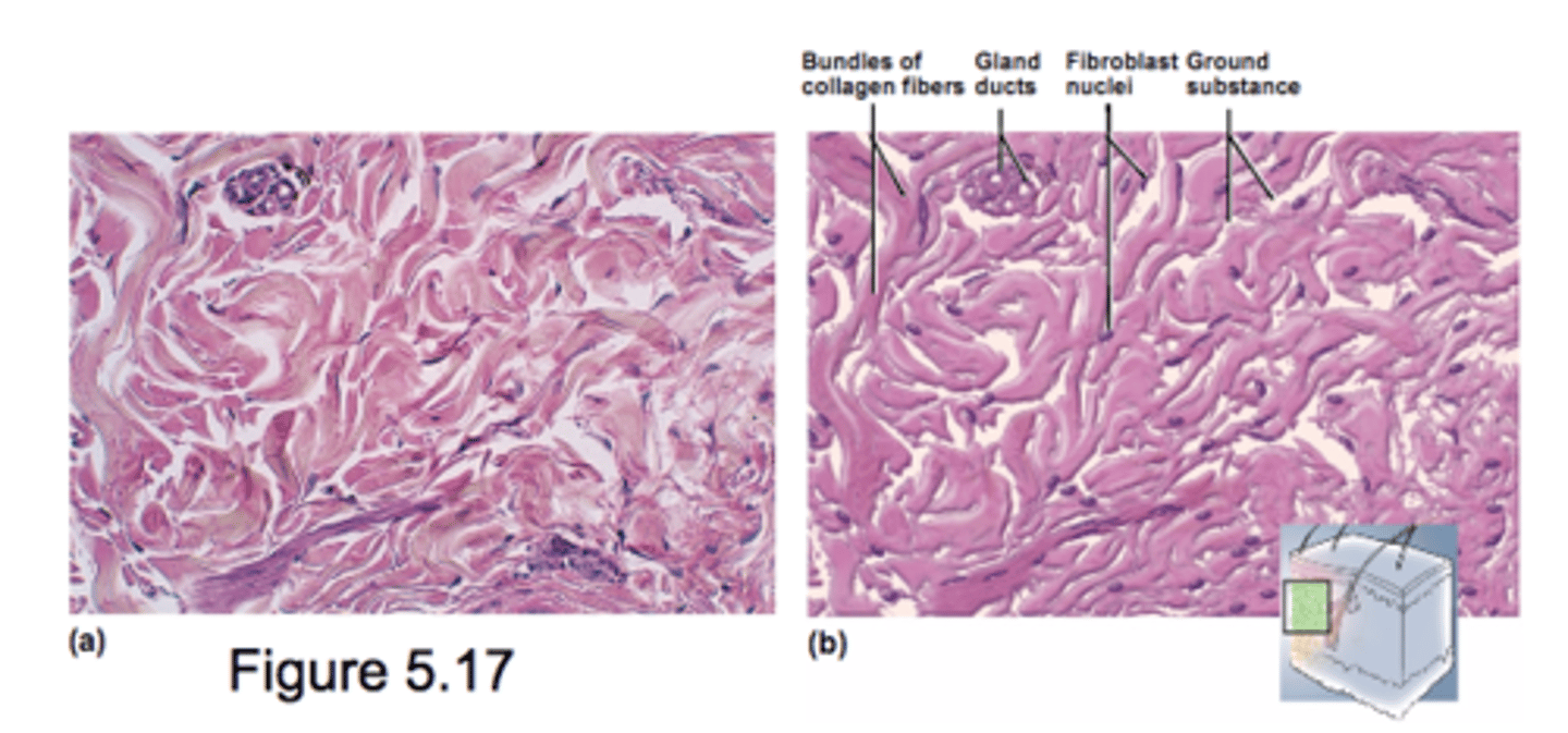 <p>densely packed, randomly arranged, collagen fibers</p><p>Withstand stress applied in multiple dimensions</p><p>Deeper layer of skin</p><p>Capsules around organs</p><p>Fibroblast mostly extracellular</p>