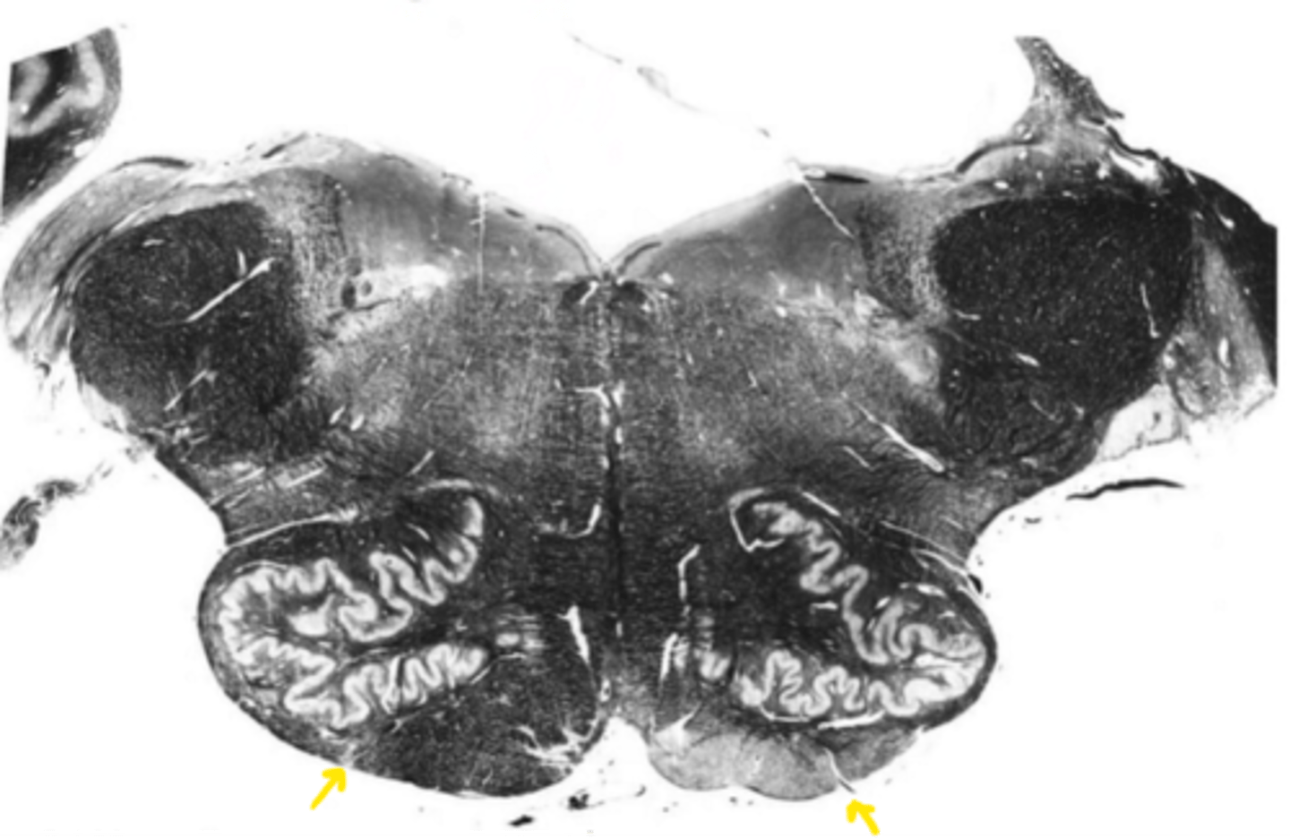 <p>ID the structure</p>